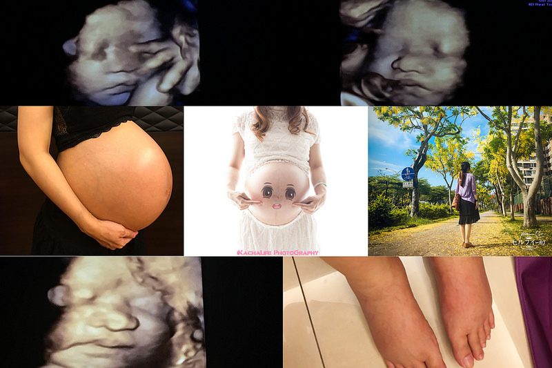 【紀錄】 小珊孕期～ 安安產檢32w~36w 懷孕後期下肢水腫好痛苦，開始等待產兆卸貨！